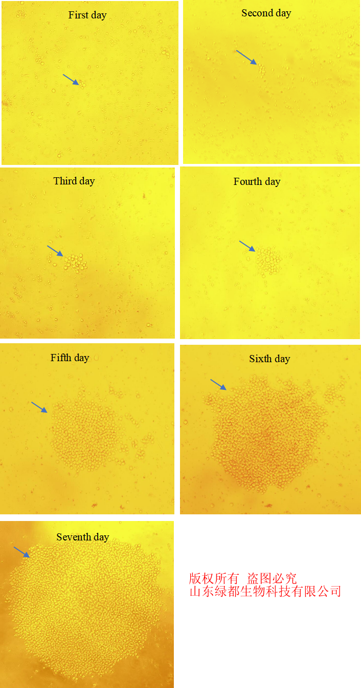微囊藻毒素LR(MC-LR)抗体  微囊藻毒素LR(MC-L