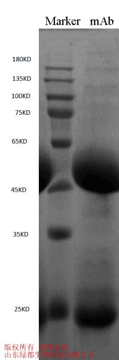 微囊藻毒素LR(MC-LR)抗体  微囊藻毒素LR(MC-L
