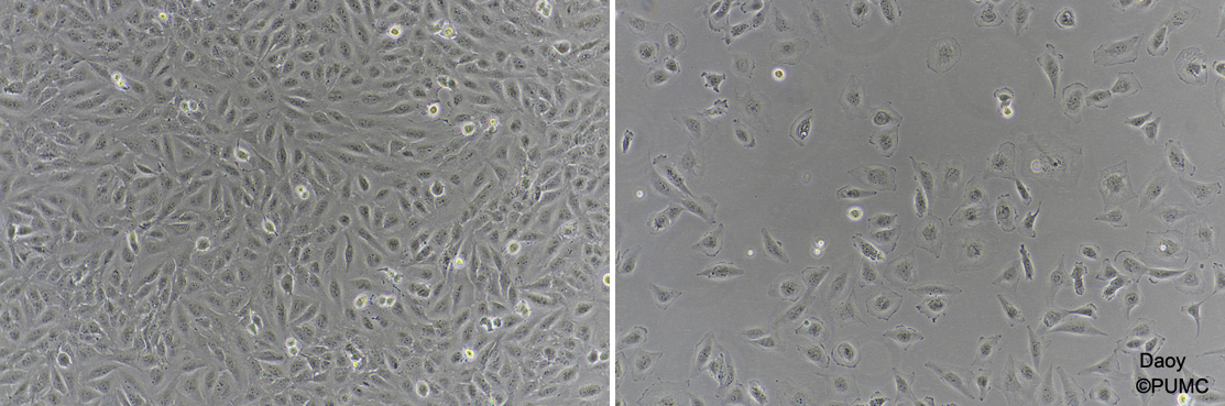 Daoy[DAOY; D324 Med]髓母细胞瘤细胞