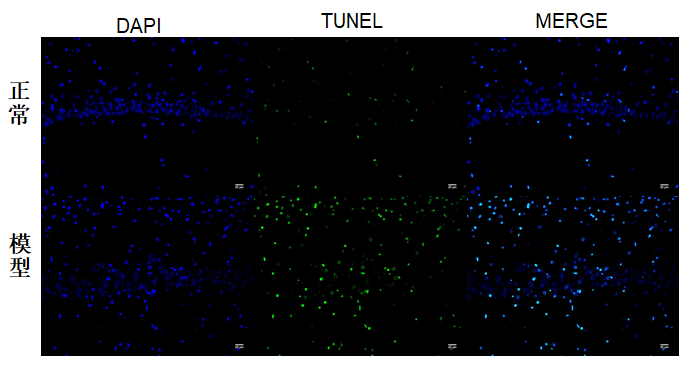 TUNEL染色