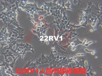 22RV1【22RV1; 22Rv-1; 22rV1; CWR-22rv1; CWR22-Rv1; CWR22R-V1; CWR22-R1; CWR22Rv1; CWR22R】前列腺癌细胞