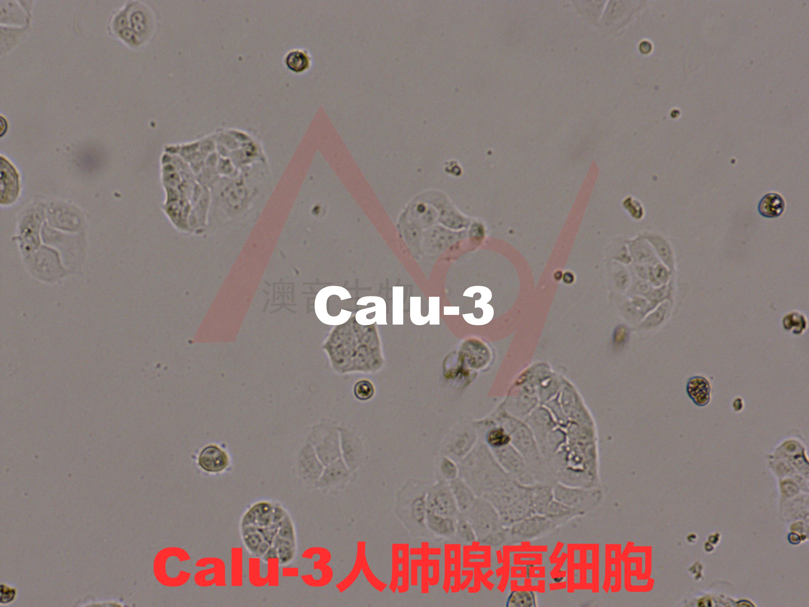 Calu-3[CaLu-3; CALU-3; Calu 3; Calu3; CALU3]肺腺癌 (胸水)