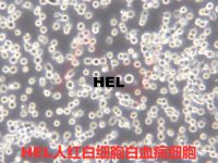 HEL【Hel; GM06141; GM06141B; Human ErythroLeukemia】红白细胞白血病细胞