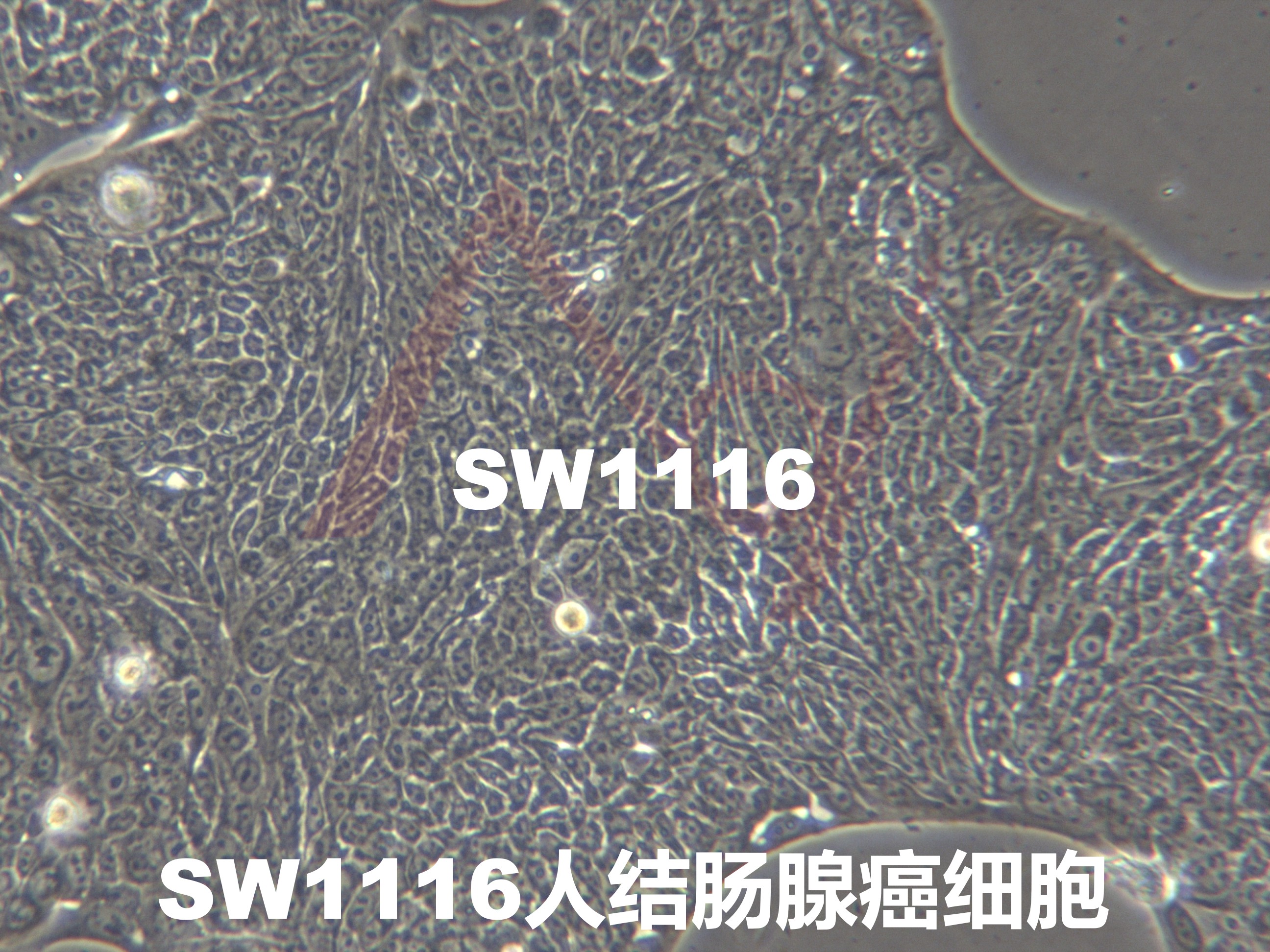 SW1116【SW-1116; SW 1116】结肠腺癌细胞