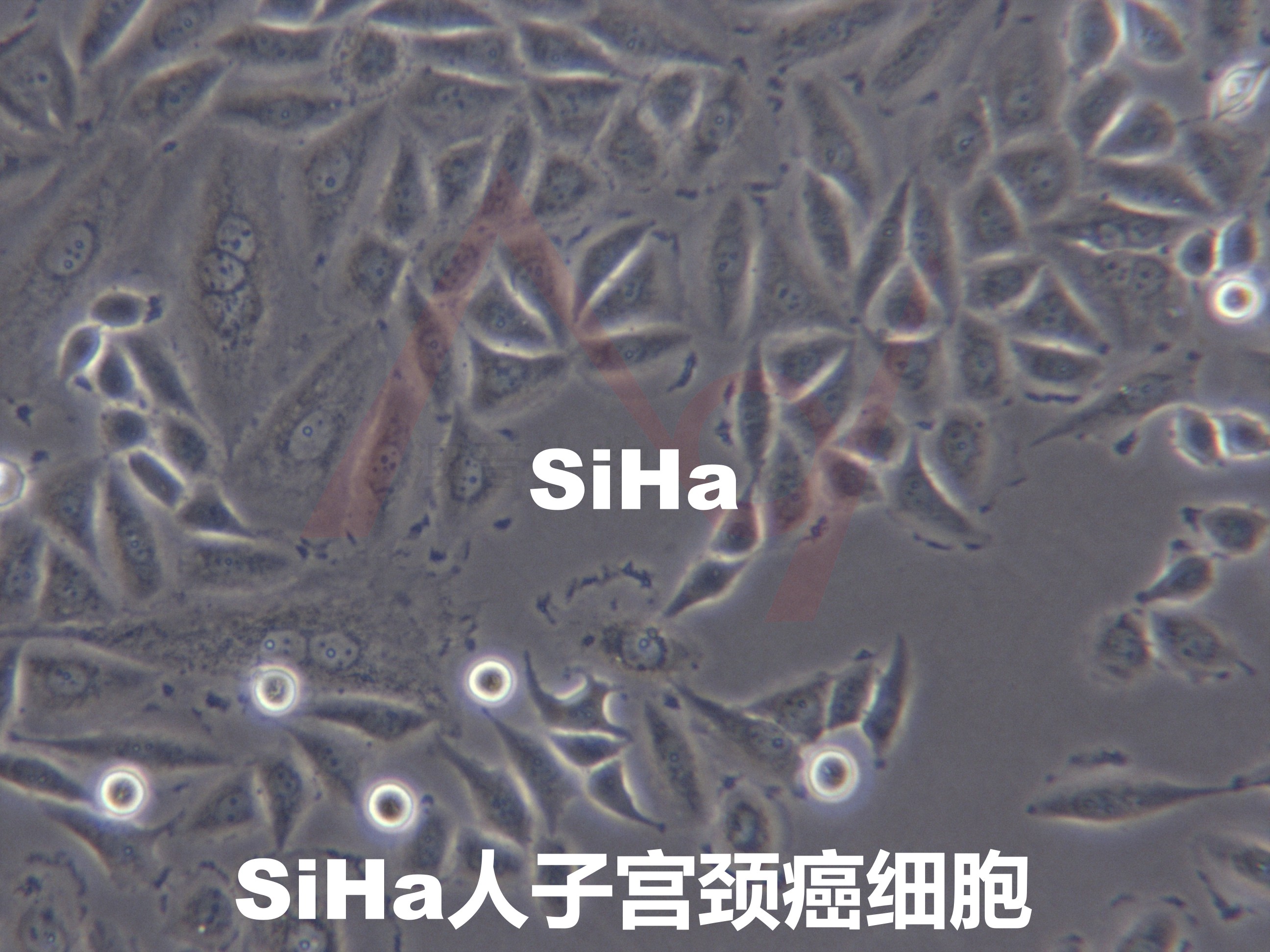 SiHa[Siha; SIHA]子宫颈癌细胞