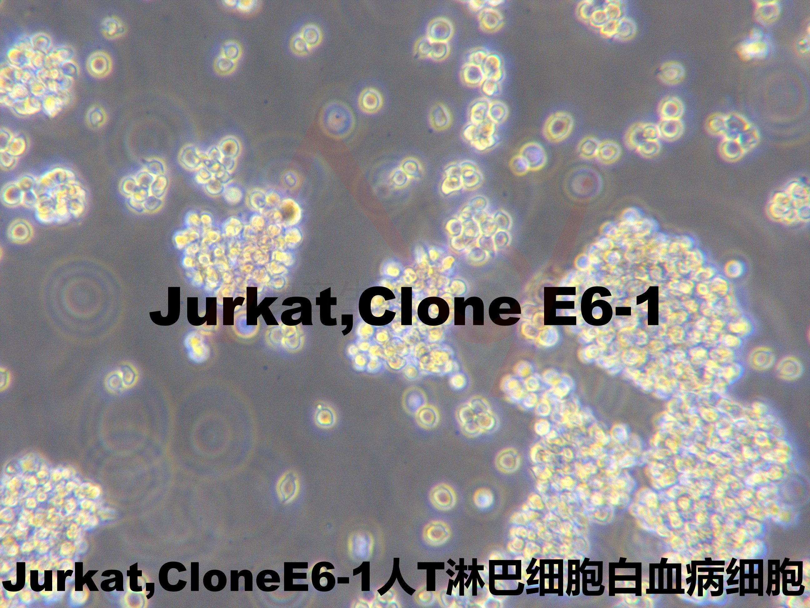 Jurkat, Clone E6-1[JurkatE6-1; Jurkat E6-1; Jurkat, Clone E6-1; Jurkat Clone E6-1;  JURKAT E-6.1; JURKAT E-61; Jurkat-E6; Jurkat E6; J.E6-1; E6-1]T淋巴细胞白血病细胞