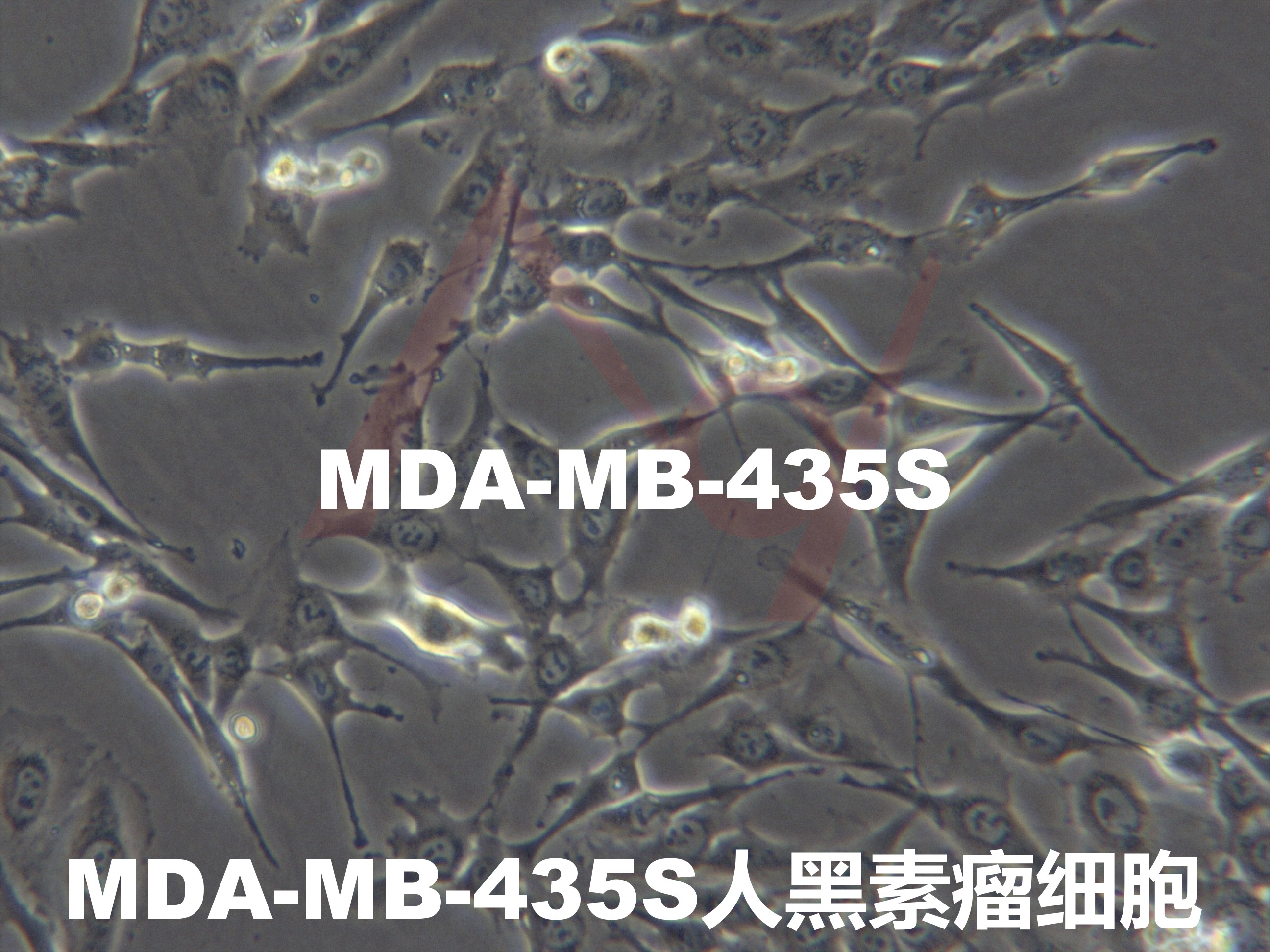 MDA-MB-435S[MDA-MB-435s; MDA-MB-435 S; MDA-MB-435-S; MDAMB435S; BrCL15]黑素瘤细胞