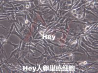 hey[HEY]卵巢癌细胞