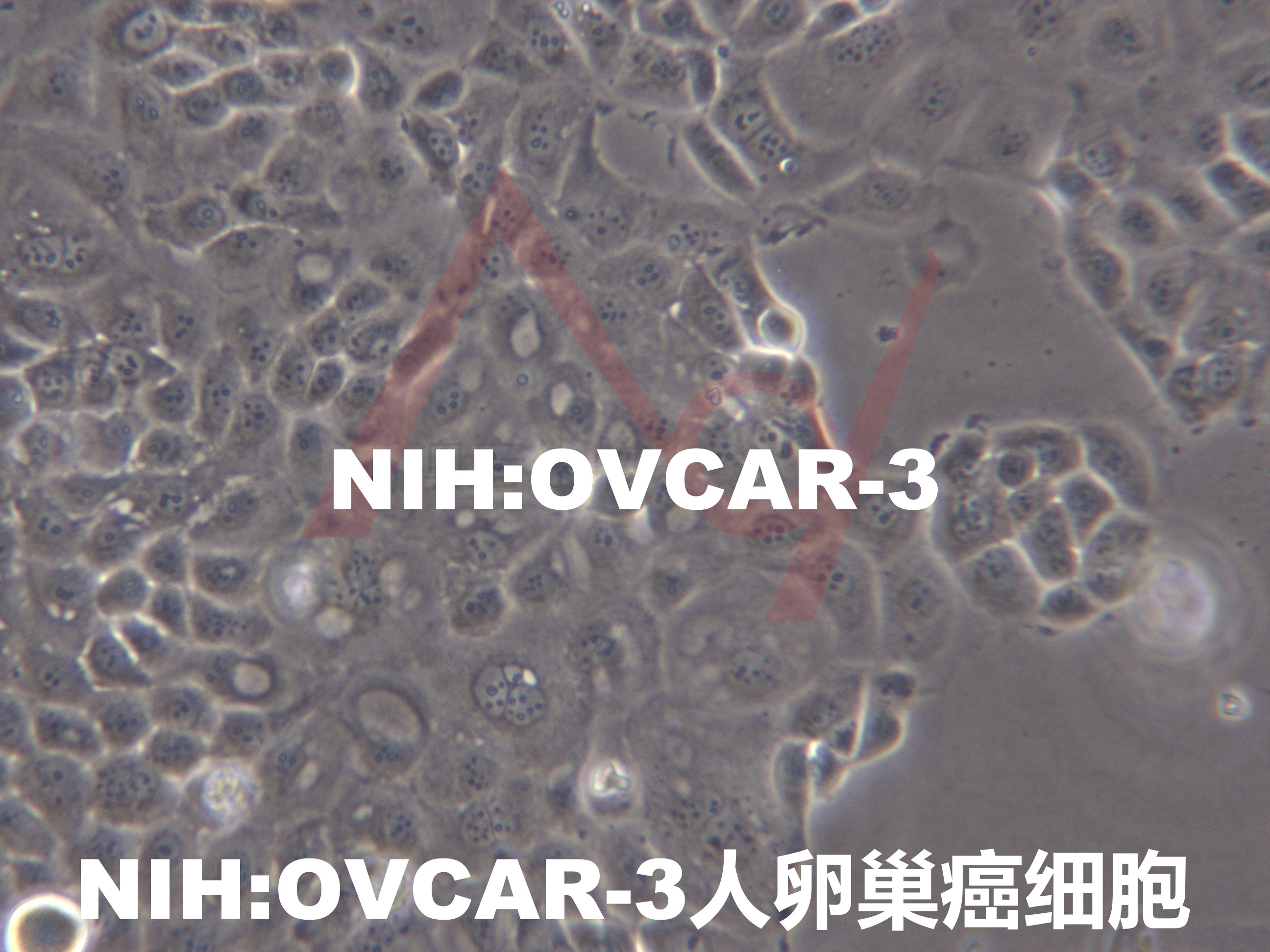 OVCAR-3[Ovcar-3; OVCAR 3; NIH:OVCAR-3; NIH:Ovcar-3; NIH:OVCAR3; NIH-OVCAR-3]卵巢癌细胞