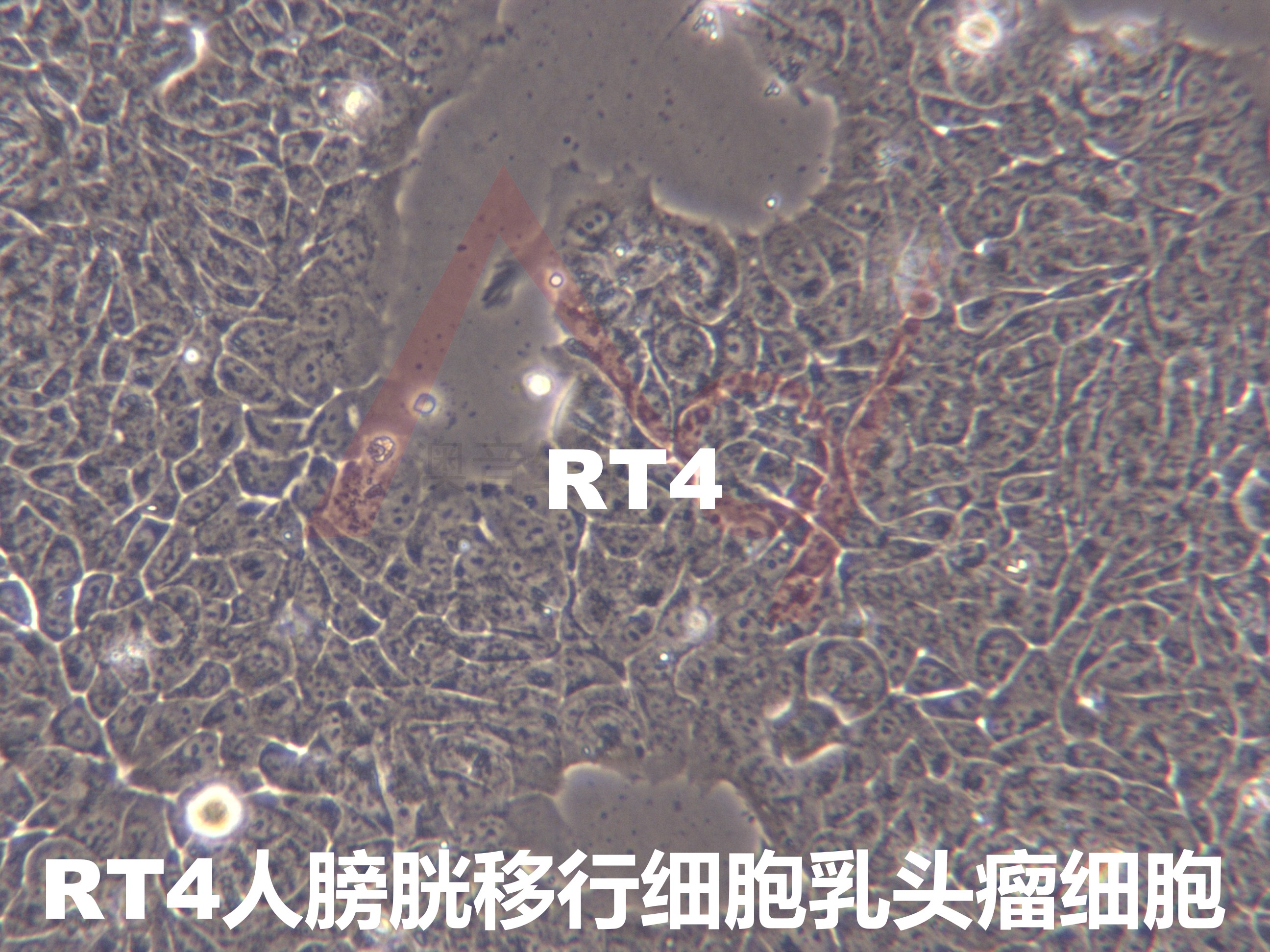 RT4[RT4; RT4P]人膀胱移行细胞乳头瘤细胞