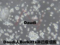 Daudi[DAUDI; NK-10A; NK-10a; NK 10a; NK10a; GM03190; GM3190; GM03190A; GM17346]人Burkitts淋巴瘤细胞