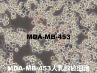MDA-MB-453[MDA-MB 453; MDA MB 453; MDA-MB453; MDAMB453; MDA-453; MDA453; MD Anderson-Metastatic Breast-453]人乳腺癌细胞