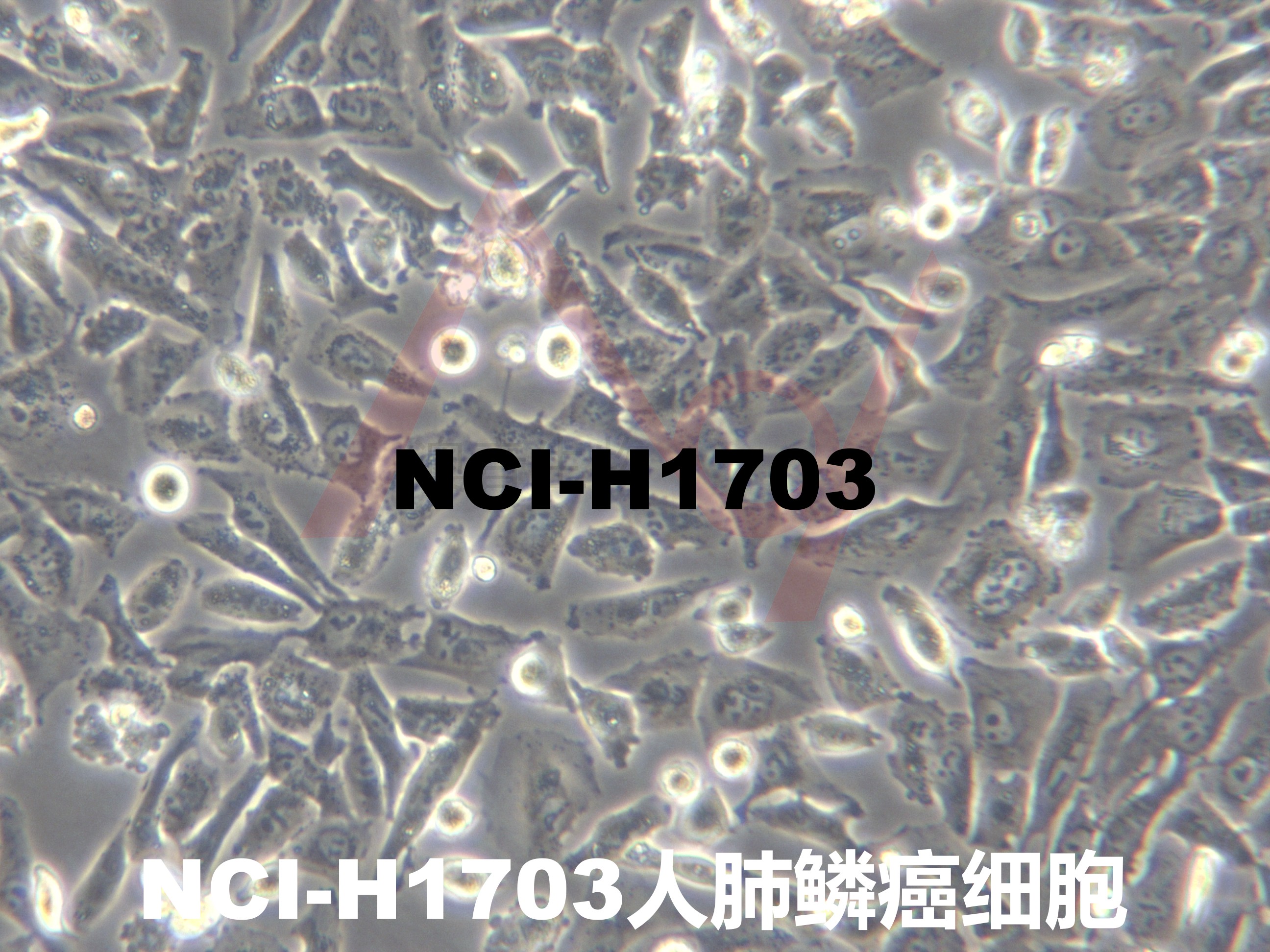 NCI-H1703[H1703; H-1703; NCIH1703]肺鳞癌细胞