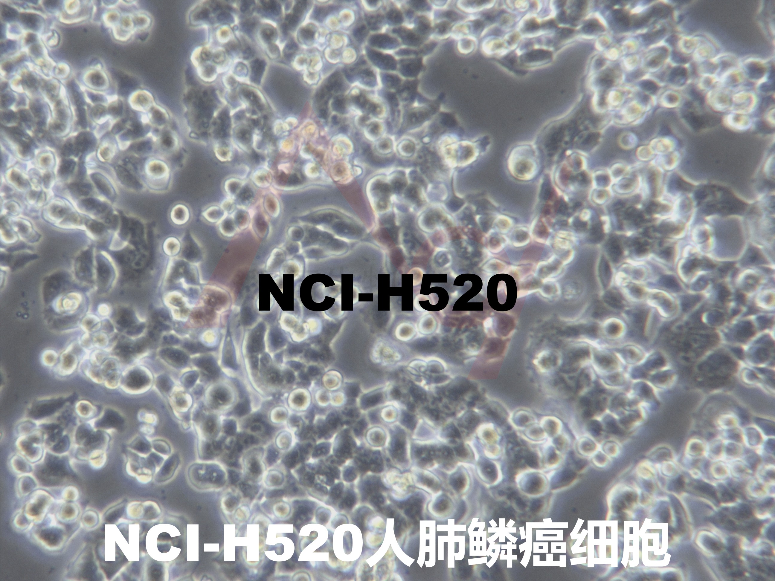 NCI-H520[H520; H-520; NCI-HUT-520; NCIH520]肺鳞癌细胞