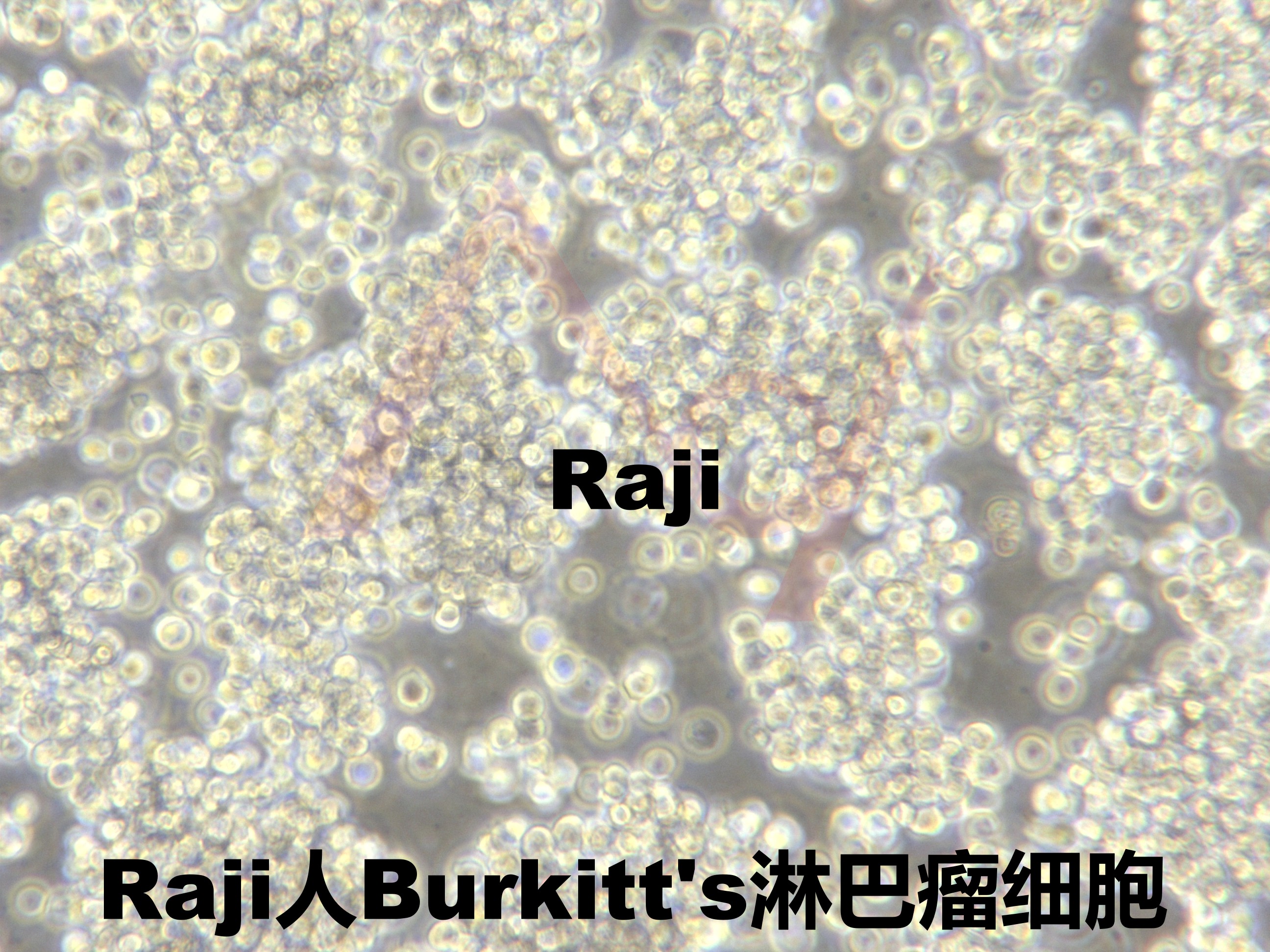 Raji [RAJI; P1-Raji; GM04671]人Burkitt's淋巴瘤细胞