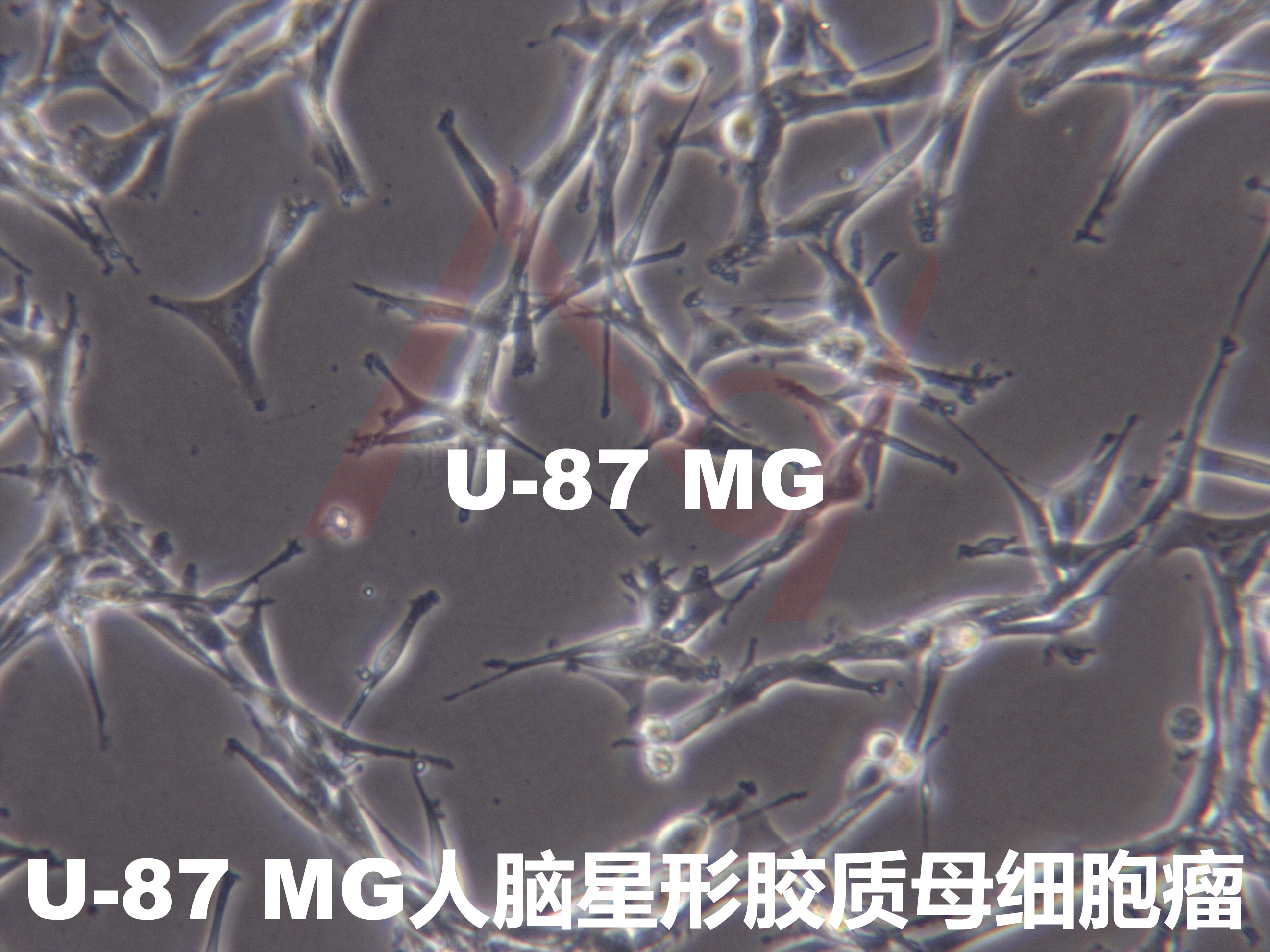 U-87 MG[U-87MG; U87 MG; U-87-MG; U87-MG; U87MG; U-87; U87; 87 MG; 87MG]脑星形胶质母细胞瘤