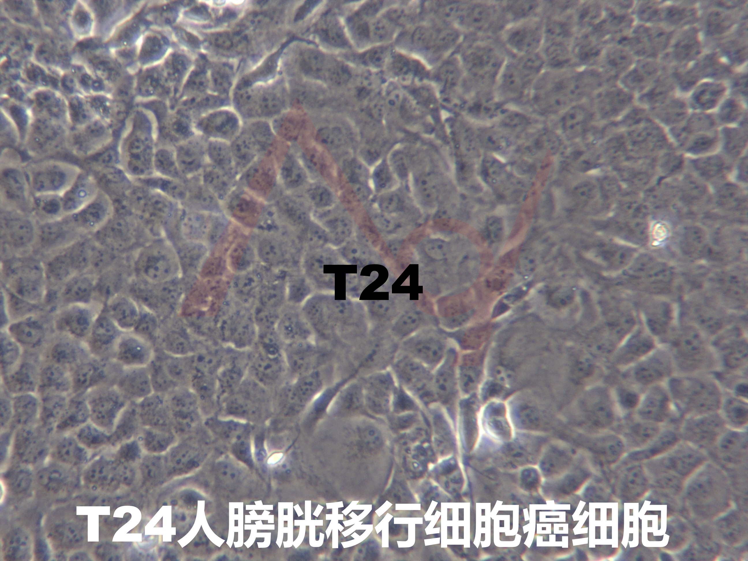 T24 【T-24; T 24】膀胱移行细胞癌细胞