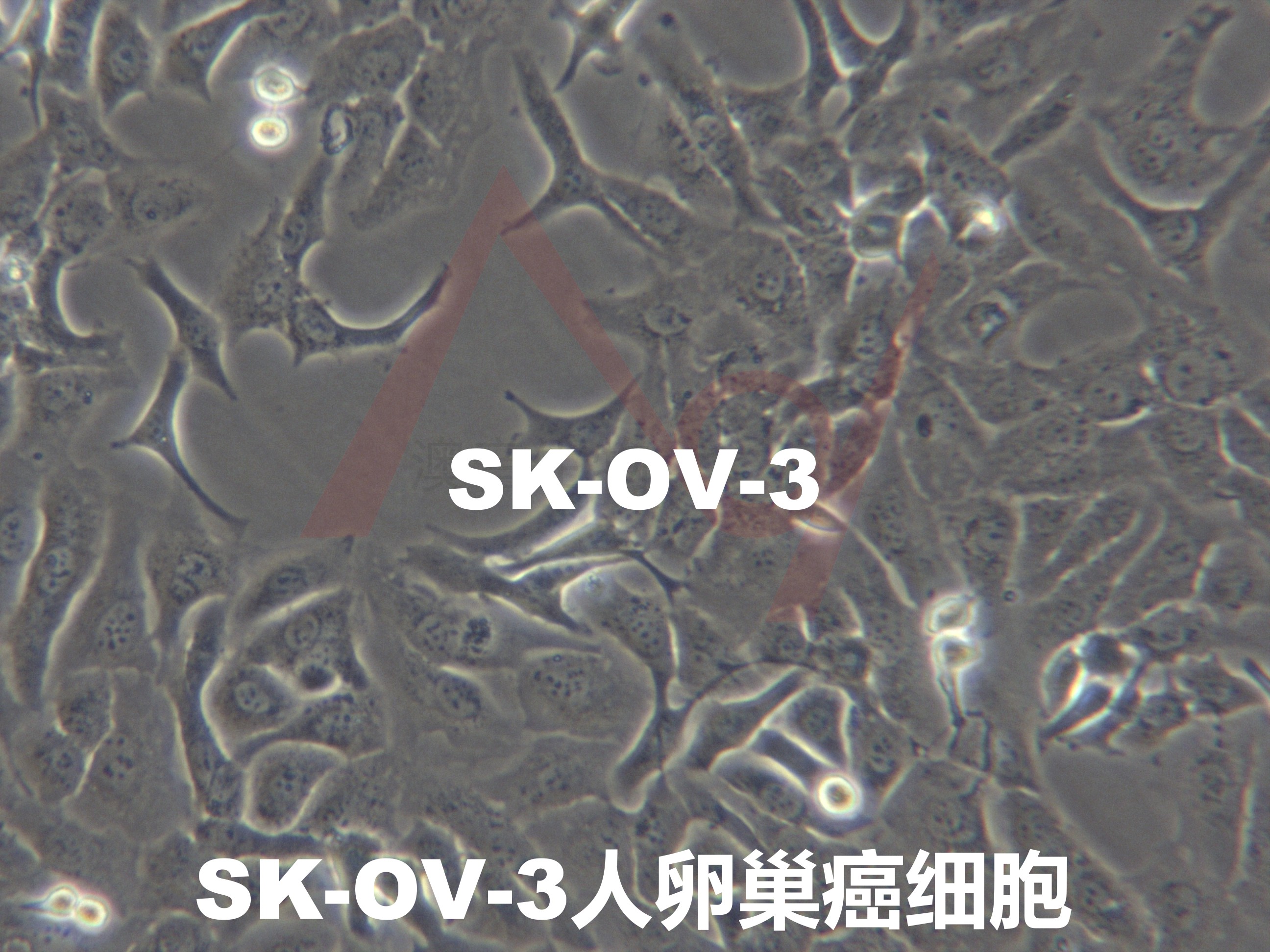 SK-OV-3[SKOV-3; SK.OV.3; SKOV3; Skov3; SKO3]卵巢癌细胞