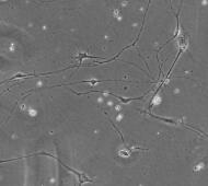 小鼠脊髓神经元