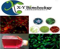 人前列腺癌组织源细胞