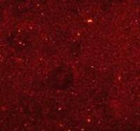 小鼠冠状微血管内皮细胞