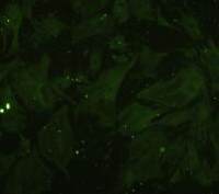 小鼠胰腺星状细胞