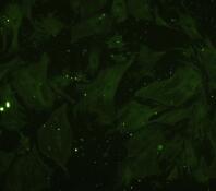 小鼠胰腺星状细胞