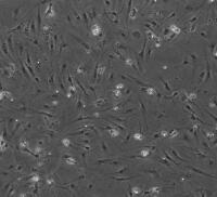 小鼠肝窦内皮细胞