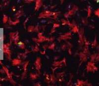 小鼠肝星状细胞