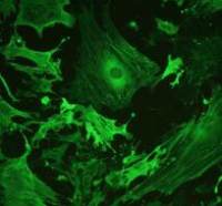 小鼠心肌成纤维细胞