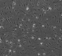 小鼠肝窦内皮细胞