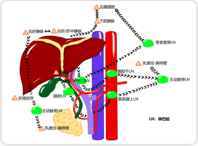 肝门的淋巴液直接汇入腹腔干 ln 最终通过主动脉旁 ln 与乳糜池连接