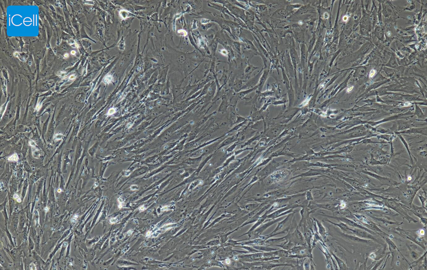 小鼠结肠成纤维细胞/免疫荧光鉴定