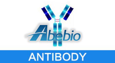 Rabbit Anti-Human DcR1 Polyclonal Antibody