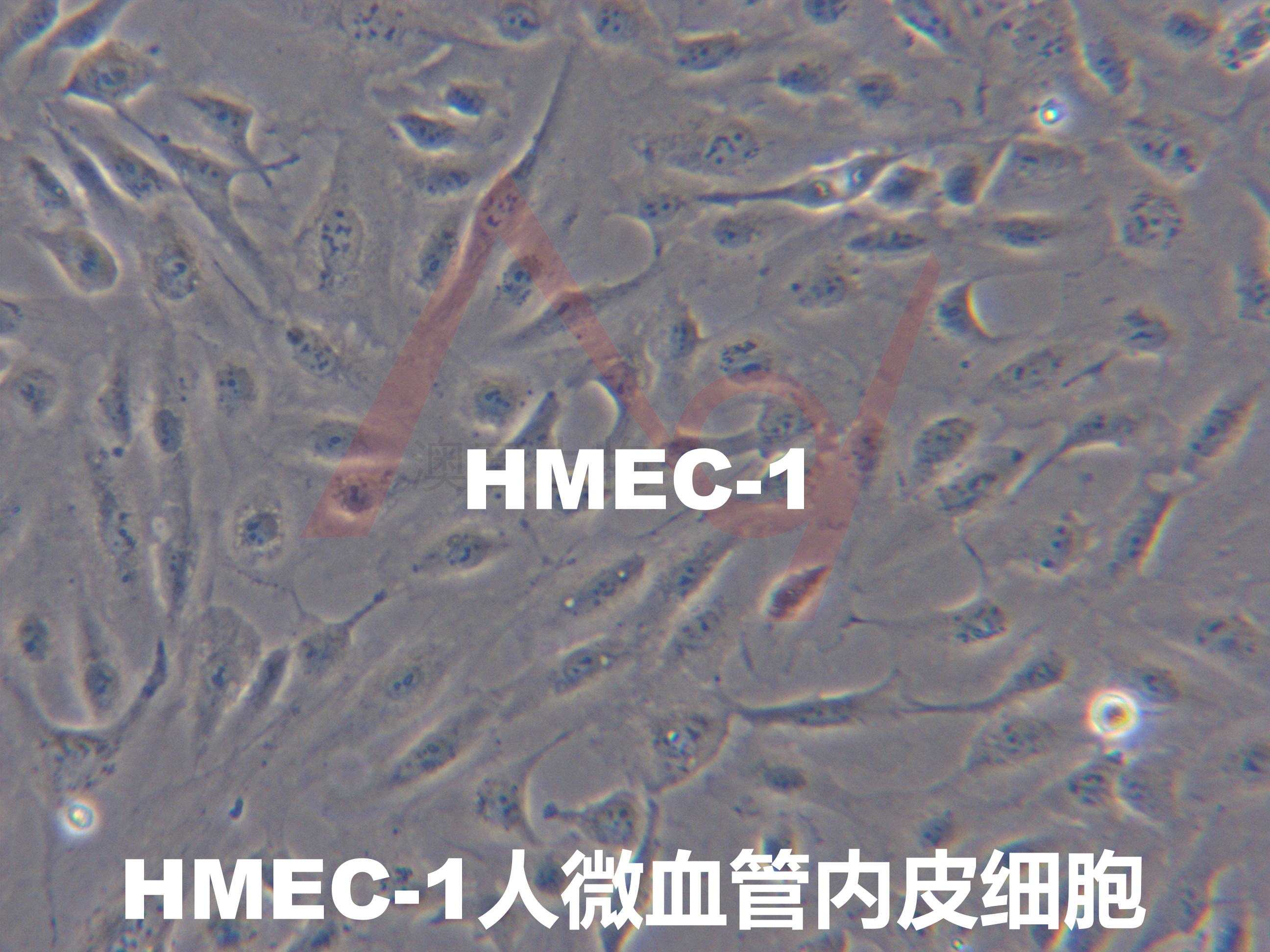 HMEC-1【Hmec-1; HMEC1; CDC/EU.HMEC-1】微血管内皮细胞