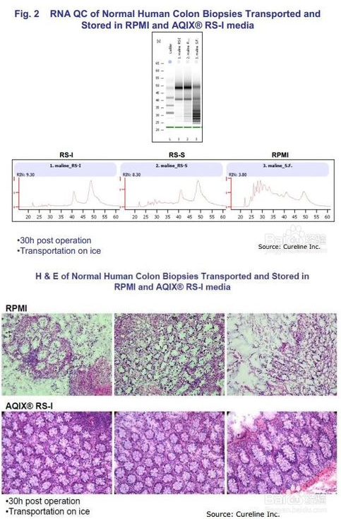 AQIX® RS-I Medium 培养基