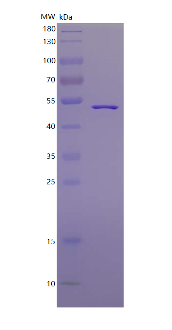 SARS-CoV-2 Nucleocapsid protei