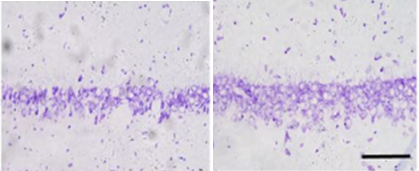血管性痴呆动物模型