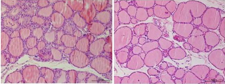 甲状腺功能亢进动物模型