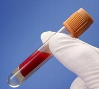 德国PAA普通胎牛血清