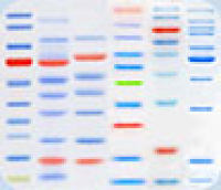 WB/Western Blot/蛋白免疫印迹