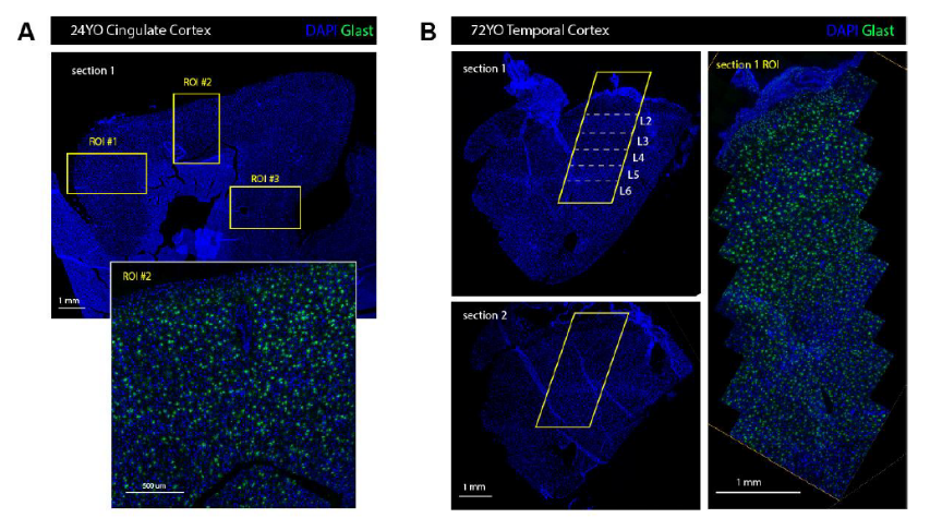 什么?珀金埃尔默高内涵竟然那么适合脑切片!!!