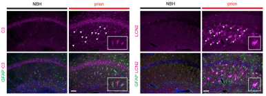 什么?珀金埃尔默高内涵竟然那么适合脑切片!!!