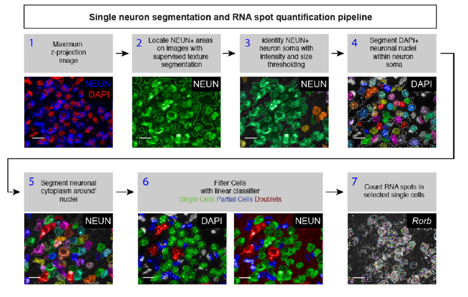 什么?珀金埃尔默高内涵竟然那么适合脑切片!!!
