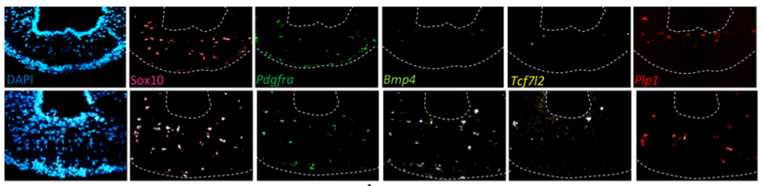 什么?珀金埃尔默高内涵竟然那么适合脑切片!!!