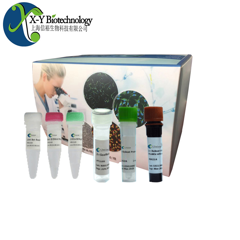 细粒棘球绦虫染料法荧光定量PCR试剂盒