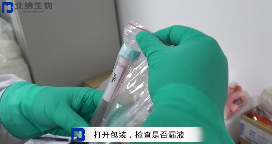 收到悬浮细胞如何处理？