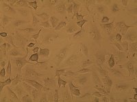 人尤因肉瘤细胞A673细胞