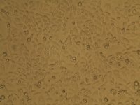 人胃腺癌细胞AGS细胞