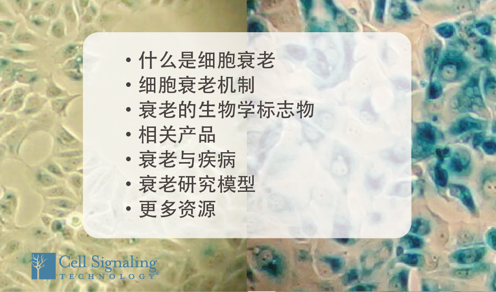 什么导致衰老？如何检测？信号转导机制如何？点我全面了解！